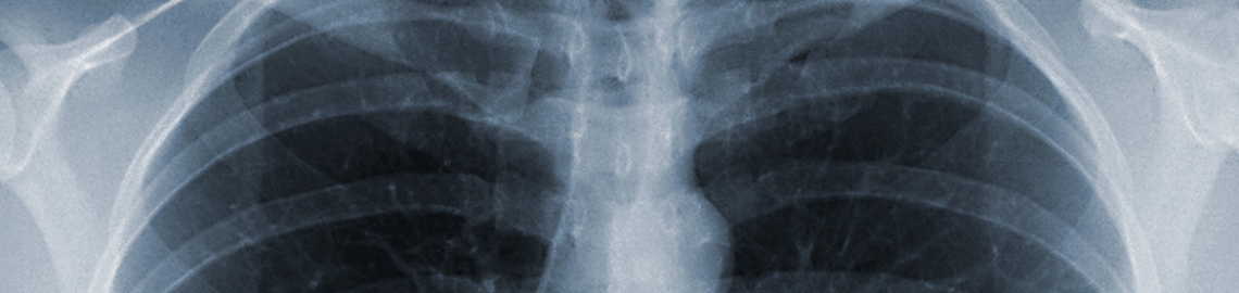 Рентген диагностика в Краевом медицинском центре