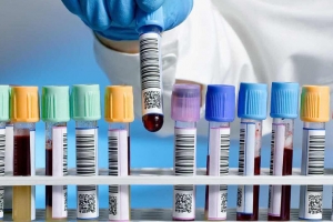 Лабораторные исследования со скидкой 10%