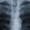 Рентген диагностика в Краевом медицинском центре